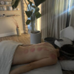 your treatment
